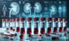 Kidney Blood Test Insights for Blackburn Residents