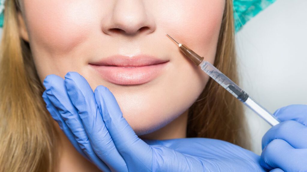 Lip Filler Simulation: Envision Your Ideal Aesthetic!