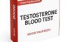 Hair Loss Blood Test: Essential Guide for Leicester Residents