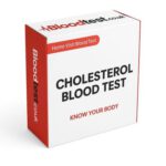 High Cholesterol Blood Test Guide for Blackpool Residents