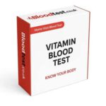 Vitamin Deficiency Blood Test Guidance from the NHS in Bath
